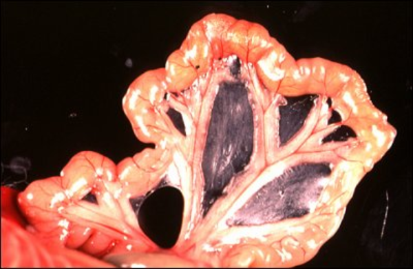 Mesentery Film