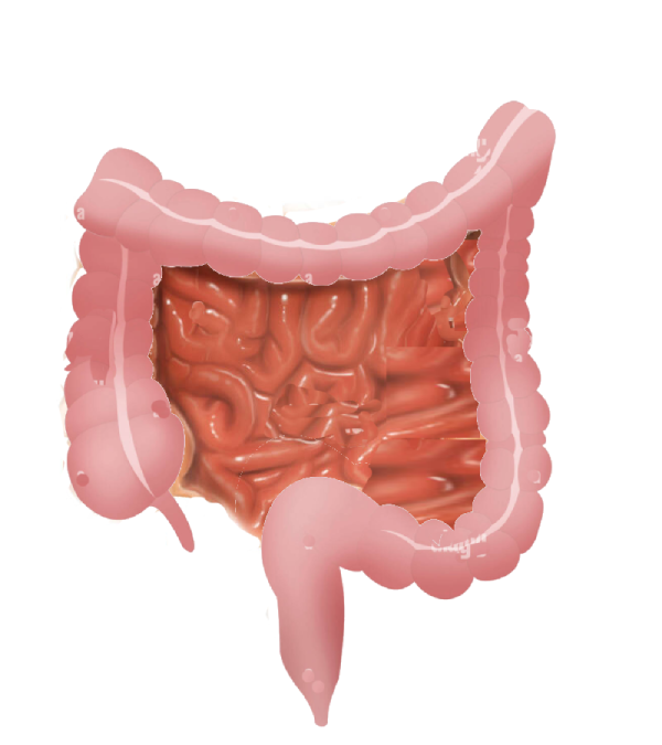 Mild Angle Splenic Flexure