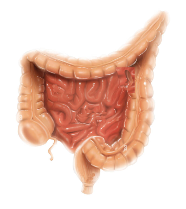Extreme Angle Splenic Flexure