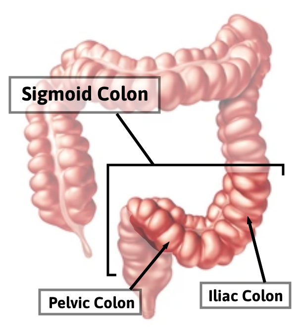 Pelvic and Iliac Colons