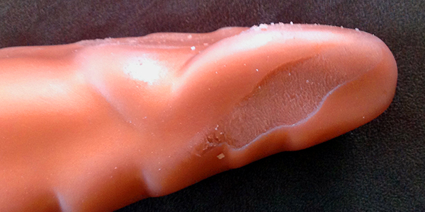 Scar from Plasticizer