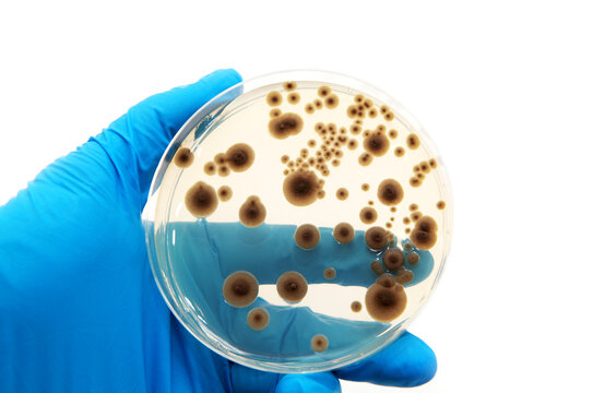 Microbial Colonization